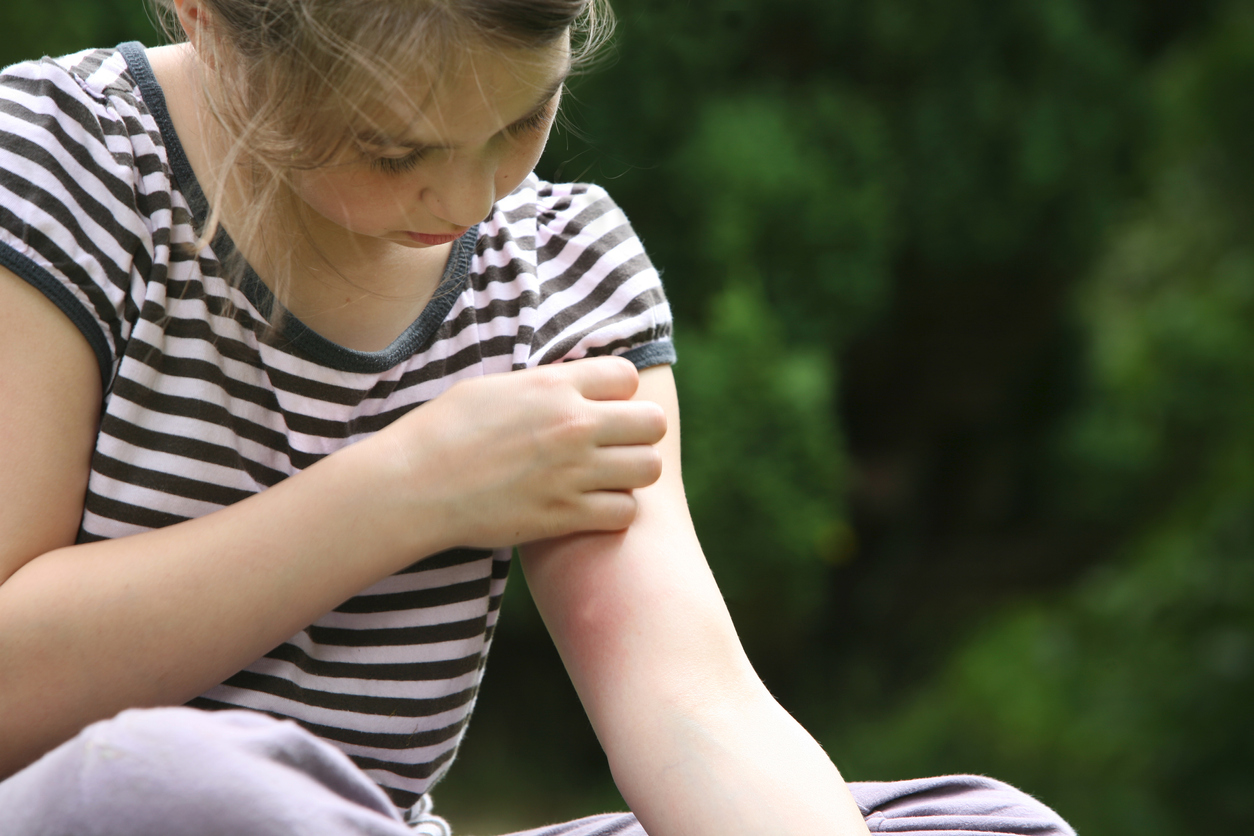 Bug Bite or Sting (Pediatric) Condition, Treatments and Pictures for  Infants - Skinsight